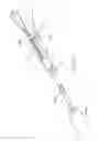 Fig. 15 - Device and method for through the scope endoscopic hemostatic clipping