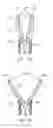 Fig. 24 - Device and method for through the scope endoscopic hemostatic clipping