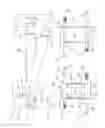 Fig. 02 - Battle application tourniquet for limb