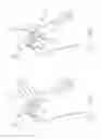 Fig. 04 - Battle application tourniquet for limb