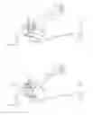 Fig. 05 - Battle application tourniquet for limb