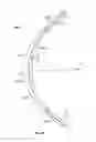Fig. 30 - Tissue displacement tools and methods