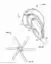 Fig. 42 - Tissue displacement tools and methods