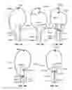 Fig. 55 - Tissue displacement tools and methods