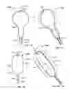 Fig. 57 - Tissue displacement tools and methods