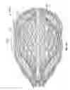 Fig. 62 - Tissue displacement tools and methods