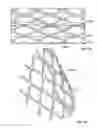 Fig. 65 - Tissue displacement tools and methods