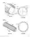 Fig. 67 - Tissue displacement tools and methods