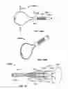 Fig. 76 - Tissue displacement tools and methods
