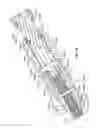 Fig. 84 - Tissue displacement tools and methods