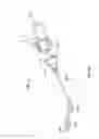 Fig. 85 - Tissue displacement tools and methods
