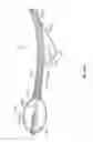 Fig. 86 - Tissue displacement tools and methods