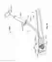 Fig. 87 - Tissue displacement tools and methods