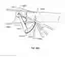 Fig. 88 - Tissue displacement tools and methods