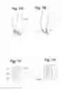 Fig. 06 - Devices and Methods for Minimally Invasive Access to Sinuses and Treatment of Sinusitis