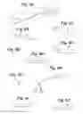 Fig. 08 - Devices and Methods for Minimally Invasive Access to Sinuses and Treatment of Sinusitis