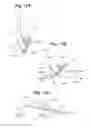 Fig. 10 - Devices and Methods for Minimally Invasive Access to Sinuses and Treatment of Sinusitis
