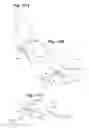 Fig. 16 - Devices and Methods for Minimally Invasive Access to Sinuses and Treatment of Sinusitis