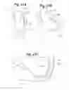 Fig. 20 - Devices and Methods for Minimally Invasive Access to Sinuses and Treatment of Sinusitis
