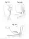 Fig. 23 - Devices and Methods for Minimally Invasive Access to Sinuses and Treatment of Sinusitis