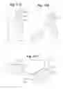 Fig. 30 - Devices and Methods for Minimally Invasive Access to Sinuses and Treatment of Sinusitis