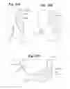 Fig. 31 - Devices and Methods for Minimally Invasive Access to Sinuses and Treatment of Sinusitis