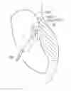 Fig. 01 - Devices and Methods For Minimally Invasive Access To Sinuses and Treatment of Sinusitis