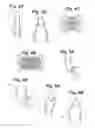 Fig. 04 - Devices and Methods For Minimally Invasive Access To Sinuses and Treatment of Sinusitis
