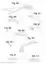 Fig. 08 - Devices and Methods For Minimally Invasive Access To Sinuses and Treatment of Sinusitis