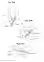Fig. 10 - Devices and Methods For Minimally Invasive Access To Sinuses and Treatment of Sinusitis