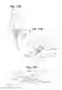 Fig. 11 - Devices and Methods For Minimally Invasive Access To Sinuses and Treatment of Sinusitis