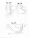 Fig. 20 - Devices and Methods For Minimally Invasive Access To Sinuses and Treatment of Sinusitis