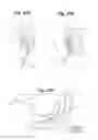 Fig. 24 - Devices and Methods For Minimally Invasive Access To Sinuses and Treatment of Sinusitis
