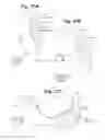 Fig. 26 - Devices and Methods For Minimally Invasive Access To Sinuses and Treatment of Sinusitis
