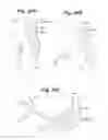 Fig. 29 - Devices and Methods For Minimally Invasive Access To Sinuses and Treatment of Sinusitis