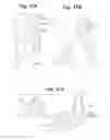Fig. 30 - Devices and Methods For Minimally Invasive Access To Sinuses and Treatment of Sinusitis