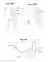 Fig. 31 - Devices and Methods For Minimally Invasive Access To Sinuses and Treatment of Sinusitis