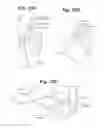 Fig. 32 - Devices and Methods For Minimally Invasive Access To Sinuses and Treatment of Sinusitis