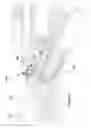Fig. 03 - Wire-guided surgical instrument
