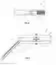 Fig. 04 - Systems, methods, and devices for endoscopic nerve release