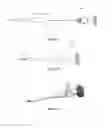 Fig. 08 - Systems, methods, and devices for endoscopic nerve release