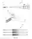 Fig. 13 - Systems, methods, and devices for endoscopic nerve release