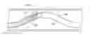 Fig. 01 - Thrombectomy catheter systems