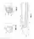 Fig. 05 - Thrombectomy catheter systems