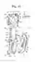 Fig. 04 - Needle guide devices for mounting on imaging transducers or adaptors on imaging transducer, imaging transducers for mounting needle guide devices and adaptors for imaging transducers for mounting needle guide devices thereon