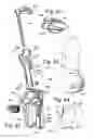 Fig. 14 - Needle guide devices for mounting on imaging transducers or adaptors on imaging transducer, imaging transducers for mounting needle guide devices and adaptors for imaging transducers for mounting needle guide devices thereon