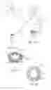 Fig. 25 - Surgical access system with navigation element and method of using same