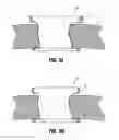Fig. 06 - Attachments for use with a surgical access device