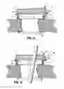 Fig. 09 - Attachments for use with a surgical access device