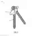 Fig. 02 - Supplemental fixation screw